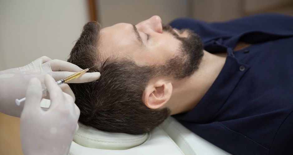 Mesoterapia Capilar